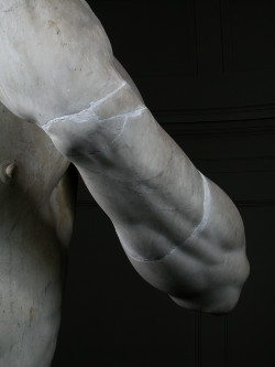 Il braccio rotto del&nbsp;David